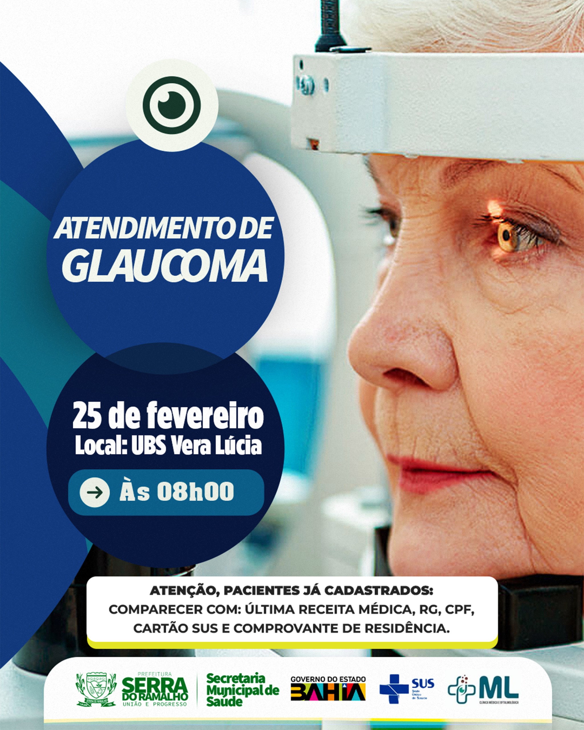 Atendimento de Glaucoma acontece dia 25 na UBS Vera Lúcia